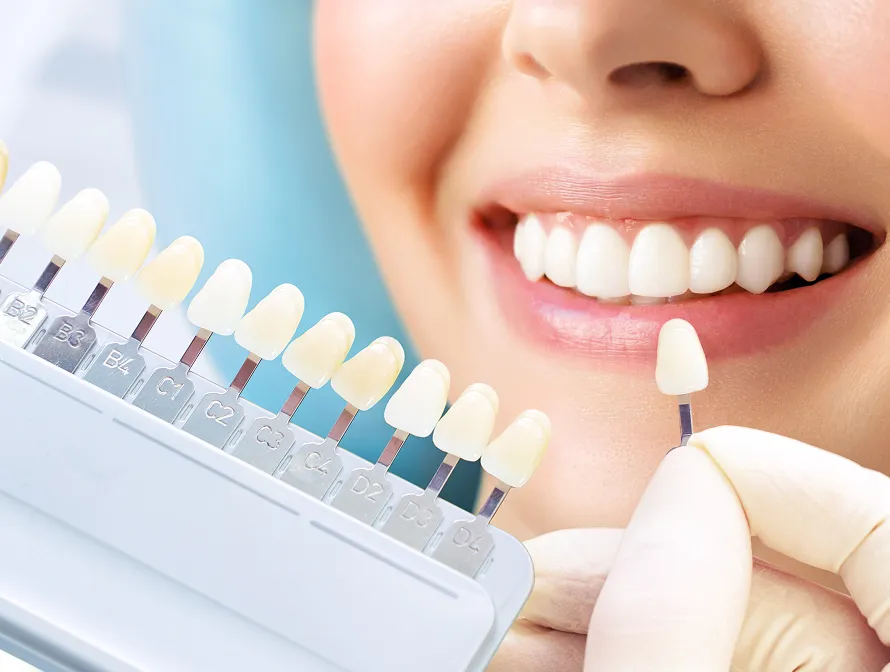 ホワイトニングとは